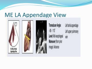 ME LA Appendage View
 