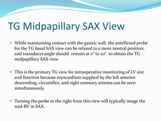 TG Midpapillary SAX View
 While maintaining contact with the gastric wall, the anteflexed probe
for the TG basal SAX view can be relaxed to a more neutral position,
and transducer angle should remain at 0° to 20°. to obtain the TG
midpapillary SAX view.
 This is the primary TG view for intraoperative monitoring of LV size
and function because myocardium supplied by the left anterior
descending, circumflex, and right coronary arteries can be seen
simultaneously.
 Turning the probe to the right from this view will typically image the
mid-RV in SAX.
 