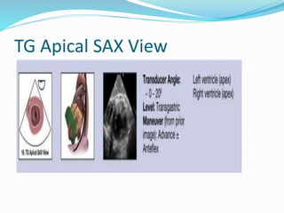 TG Apical SAX View
 