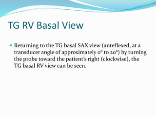 TG RV Basal View
 Returning to the TG basal SAX view (anteflexed, at a
transducer angle of approximately 0° to 20°) by turning
the probe toward the patient’s right (clockwise), the
TG basal RV view can be seen.
 