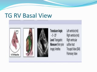 TG RV Basal View
 