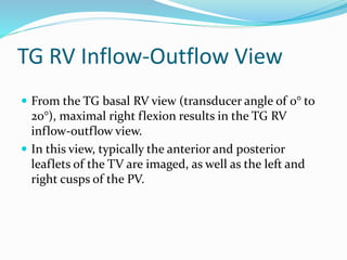 TG RV Inflow-Outflow View
 From the TG basal RV view (transducer angle of 0° to
20°), maximal right flexion results in the TG RV
inflow-outflow view.
 In this view, typically the anterior and posterior
leaflets of the TV are imaged, as well as the left and
right cusps of the PV.
 