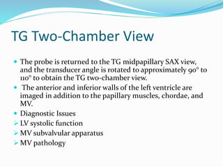 TG Two-Chamber View
 The probe is returned to the TG midpapillary SAX view,
and the transducer angle is rotated to approximately 90° to
110° to obtain the TG two-chamber view.
 The anterior and inferior walls of the left ventricle are
imaged in addition to the papillary muscles, chordae, and
MV.
 Diagnostic Issues
 LV systolic function
 MV subvalvular apparatus
 MV pathology
 