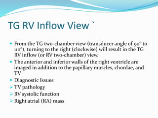 TG RV Inflow View `
 From the TG two-chamber view (transducer angle of 90° to
110°), turning to the right (clockwise) will result in the TG
RV inflow (or RV two-chamber) view.
 The anterior and inferior walls of the right ventricle are
imaged in addition to the papillary muscles, chordae, and
TV
 Diagnostic Issues
 TV pathology
 RV systolic function
 Right atrial (RA) mass
 