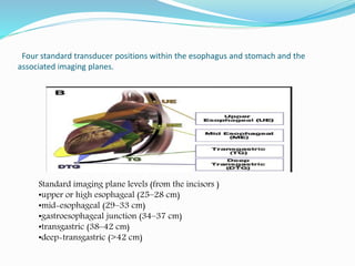 Four standard transducer positions within the esophagus and stomach and the
associated imaging planes.
Standard imaging plane levels (from the incisors )
•upper or high esophageal (25–28 cm)
•mid-esophageal (29–33 cm)
•gastroesophageal junction (34–37 cm)
•transgastric (38–42 cm)
•deep-transgastric (>42 cm)
 