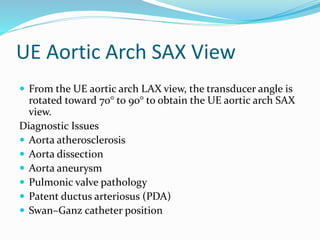 UE Aortic Arch SAX View
 From the UE aortic arch LAX view, the transducer angle is
rotated toward 70° to 90° to obtain the UE aortic arch SAX
view.
Diagnostic Issues
 Aorta atherosclerosis
 Aorta dissection
 Aorta aneurysm
 Pulmonic valve pathology
 Patent ductus arteriosus (PDA)
 Swan–Ganz catheter position
 