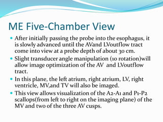 ME Five-Chamber View
 After initially passing the probe into the esophagus, it
is slowly advanced until the AVand LVoutflow tract
come into view at a probe depth of about 30 cm.
 Slight transducer angle manipulation (10 rotation)will
allow image optimization of the AV and LVoutflow
tract.
 In this plane, the left atrium, right atrium, LV, right
ventricle, MV,and TV will also be imaged.
 This view allows visualization of the A2-A1 and P1-P2
scallops(from left to right on the imaging plane) of the
MV and two of the three AV cusps.
 