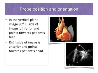Probe position and orientation
• In the vertical plane
image 900, L side of
image is inferior and
points towards patient’s
feet.
• Right side of image is
anterior and points
towards patient’s head.
 