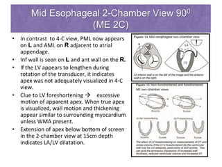 Mid Esophageal 2-Chamber View 900
(ME 2C)
• In contrast to 4-C view, PML now appears
on L and AML on R adjacent to atrial
appendage.
• Inf wall is seen on L and ant wall on the R.
• If the LV appears to lengthen during
rotation of the transducer, it indicates
apex was not adequately visualized in 4-C
view.
• Clue to LV foreshortening  excessive
motion of apparent apex. When true apex
is visualized, wall motion and thickening
appear similar to surrounding myocardium
unless WMA present.
• Extension of apex below bottom of screen
in the 2-chamber view at 15cm depth
indicates LA/LV dilatation.
 