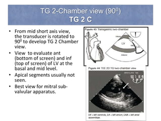 TG 2-Chamber view (900)
TG 2 C
• From mid short axis view,
the transducer is rotated to
900 to develop TG 2 Chamber
view.
• View to evaluate ant
(bottom of screen) and inf
(top of screen) of LV at the
basal and mid level.
• Apical segments usually not
seen.
• Best view for mitral sub-
valvular apparatus.
 