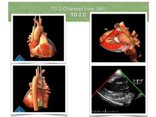 TG 2-Chamber view (900)
TG 2 C
 