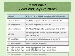 Mitral Valve
Views and Key Structures
 