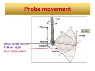 Probe movement
Small wheel rotation
Left and right
Large wheel rotation
0-1800
 