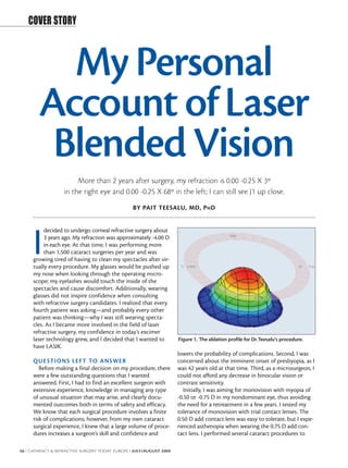 COVER STORY



          My Personal
        Account of Laser
         Blended Vision
                        More than 2 years after surgery, my refraction is 0.00 -0.25 X 3º
                   in the right eye and 0.00 -0.25 X 68º in the left; I can still see J1 up close.
                                                 BY PAIT TEESALU, MD, P H D


          decided to undergo corneal refractive surgery about


     I    3 years ago. My refraction was approximately -4.00 D
          in each eye. At that time, I was performing more
          than 1,500 cataract surgeries per year and was
     growing tired of having to clean my spectacles after vir-
     tually every procedure. My glasses would be pushed up
     my nose when looking through the operating micro-
     scope; my eyelashes would touch the inside of the
     spectacles and cause discomfort. Additionally, wearing
     glasses did not inspire confidence when consulting
     with refractive surgery candidates. I realized that every
     fourth patient was asking—and probably every other
     patient was thinking—why I was still wearing specta-
     cles. As I became more involved in the field of laser
     refractive surgery, my confidence in today’s excimer
     laser technology grew, and I decided that I wanted to           Figure 1. The ablation profile for Dr. Teesalu's procedure.
     have LASIK.
                                                                     lowers the probability of complications. Second, I was
     QUE STI ONS LEF T TO ANSWER                                     concerned about the imminent onset of presbyopia, as I
        Before making a final decision on my procedure, there        was 42 years old at that time. Third, as a microsurgeon, I
     were a few outstanding questions that I wanted                  could not afford any decrease in binocular vision or
     answered. First, I had to find an excellent surgeon with        contrast sensitivity.
     extensive experience, knowledge in managing any type               Initially, I was aiming for monovision with myopia of
     of unusual situation that may arise, and clearly docu-          -0.50 or -0.75 D in my nondominant eye, thus avoiding
     mented outcomes both in terms of safety and efficacy.           the need for a retreatment in a few years. I tested my
     We know that each surgical procedure involves a finite          tolerance of monovision with trial contact lenses. The
     risk of complications; however, from my own cataract            0.50 D add contact lens was easy to tolerate, but I expe-
     surgical experience, I knew that a large volume of proce-       rienced asthenopia when wearing the 0.75 D add con-
     dures increases a surgeon’s skill and confidence and            tact lens. I performed several cataract procedures to

56 I CATARACT & REFRACTIVE SURGERY TODAY EUROPE I JULY/AUGUST 2009
 