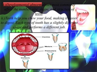 i.)Developmental abnormalities most commonly
affect the number, size, shape, and structure of
teeth.
ii.)Teeth help you chew your food, making it easier
to digest. Each type of tooth has a slightly different
shape and performs a different job.

 