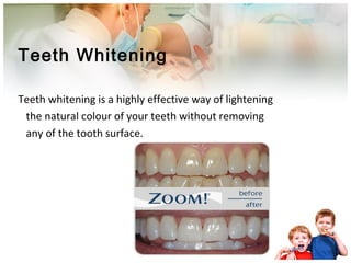 Teeth Whitening
Teeth whitening is a highly effective way of lightening
the natural colour of your teeth without removing
any of the tooth surface.
 