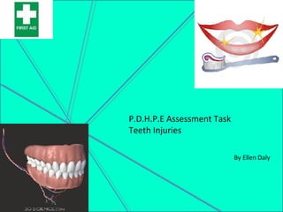 P.D.H.P.E Assessment Task Teeth Injuries   By Ellen Daly 