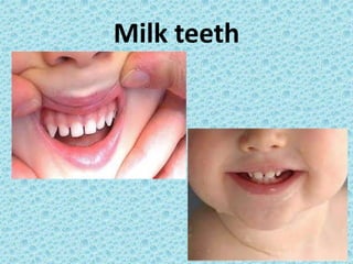 Milk teeth
 