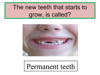 The new teeth that starts to
grow, is called?
Permanent teeth