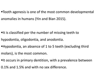 Tooth agenesis is one of the most common developmental
anomalies in humans (Yin and Bian 2015).
It is classified per the number of missing teeth to
hypodontia, oligodontia, and anodontia.
Hypodontia, an absence of 1 to 5 teeth (excluding third
molars), is the most common.
It occurs in primary dentition, with a prevalence between
0.1% and 1.5% and with no sex difference.
 