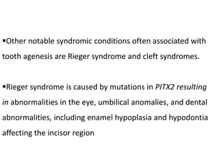 Other notable syndromic conditions often associated with
tooth agenesis are Rieger syndrome and cleft syndromes.
Rieger syndrome is caused by mutations in PITX2 resulting
in abnormalities in the eye, umbilical anomalies, and dental
abnormalities, including enamel hypoplasia and hypodontia
affecting the incisor region
 