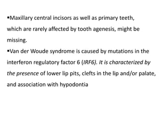 Maxillary central incisors as well as primary teeth,
which are rarely affected by tooth agenesis, might be
missing.
Van der Woude syndrome is caused by mutations in the
interferon regulatory factor 6 (IRF6). It is characterized by
the presence of lower lip pits, clefts in the lip and/or palate,
and association with hypodontia
 