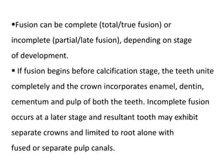 Fusion can be complete (total/true fusion) or
incomplete (partial/late fusion), depending on stage
of development.
 If fusion begins before calcification stage, the teeth unite
completely and the crown incorporates enamel, dentin,
cementum and pulp of both the teeth. Incomplete fusion
occurs at a later stage and resultant tooth may exhibit
separate crowns and limited to root alone with
fused or separate pulp canals.
 