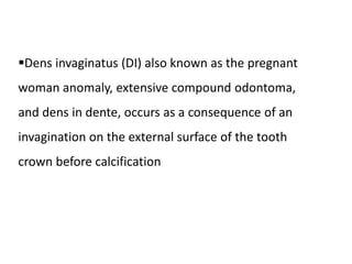 Dens invaginatus (DI) also known as the pregnant
woman anomaly, extensive compound odontoma,
and dens in dente, occurs as a consequence of an
invagination on the external surface of the tooth
crown before calcification
 