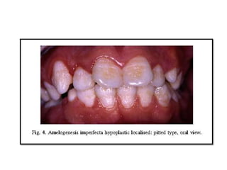 dental abnormalities on genetic background (new vision).pptx