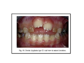 dental abnormalities on genetic background (new vision).pptx