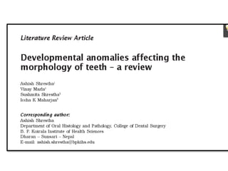 dental abnormalities on genetic background (new vision).pptx