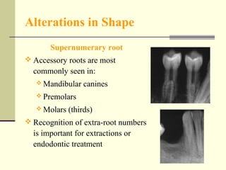 Teeth abnormalities ii | PPT