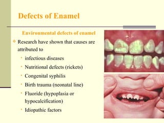 Teeth abnormalities ii | PPT