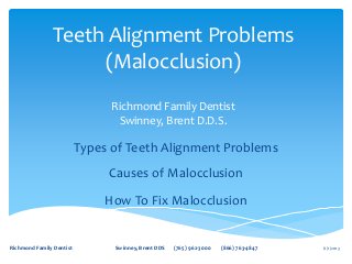 6/1/2013Richmond Family Dentist Swinney, Brent DDS (765) 962-3000 (866) 763-4847
Teeth Alignment Problems
(Malocclusion)
Richmond Family Dentist
Swinney, Brent D.D.S.
Types of Teeth Alignment Problems
Causes of Malocclusion
How To Fix Malocclusion
 
