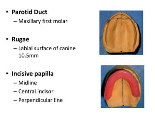 Teeth arrangement | PPTX