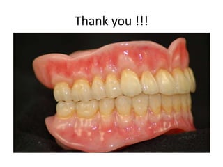 Teeth arrangement | PPTX