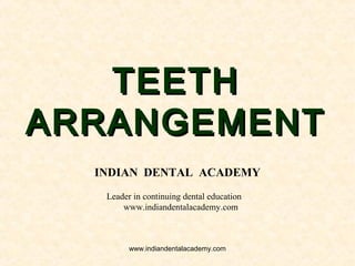 TEETHTEETH
ARRANGEMENTARRANGEMENT
INDIAN DENTAL ACADEMY
Leader in continuing dental education
www.indiandentalacademy.com
www.indiandentalacademy.com
 