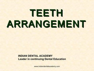 TEETHTEETH
ARRANGEMENTARRANGEMENT
INDIAN DENTAL ACADEMY
Leader in continuing Dental Education
www.indiandentalacademy.com
 