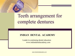 Teeth arrangement for
complete dentures
INDIAN DENTAL ACADEMY
Leader in continuing dental education
www.indiandentalacademy.com
www.indiandentalacademy.com
 