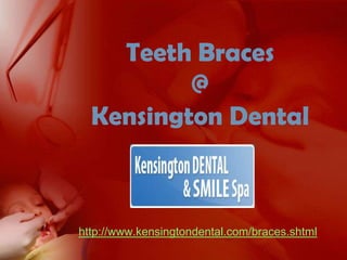 Teeth Braces @Kensington Dental http://www.kensingtondental.com/braces.shtml 