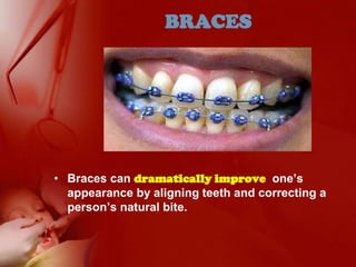 BRACESBraces can dramatically improve one’s appearance by aligning teeth and correcting a person’s natural bite.