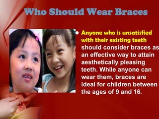 Who Should Wear BracesAnyone who is unsatisfied with their existing teeth should consider braces as an effective way to attain aesthetically pleasing teeth. While anyone can wear them, braces are ideal for children between the ages of 9 and 16.