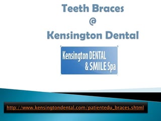 Teeth Braces @Kensington Dental http://www.kensingtondental.com/patientedu_braces.shtml 