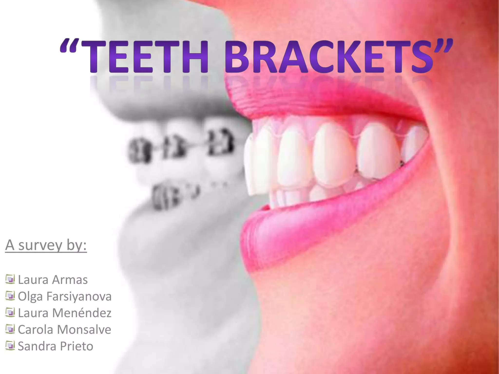 “TeethBrackets” A surveyby: Laura Armas Olga Farsiyanova Laura Menéndez Carola Monsalve Sandra Prieto