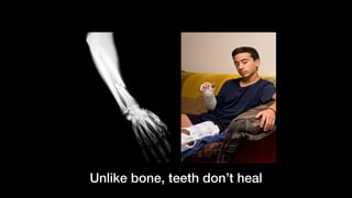 Unlike bone, teeth don’t heal
 