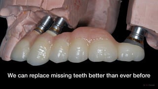 Dr. Viv Chander
We can replace missing teeth better than ever before
 