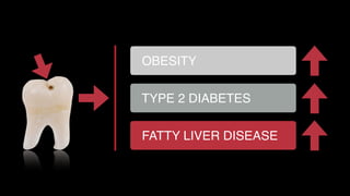 OBESITY
TYPE 2 DIABETES
FATTY LIVER DISEASE
 
