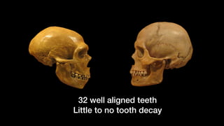 32 well aligned teeth
Little to no tooth decay
 