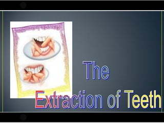 Teeth extraction(1) | PDF
