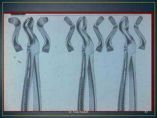 Teeth extraction(1) | PDF